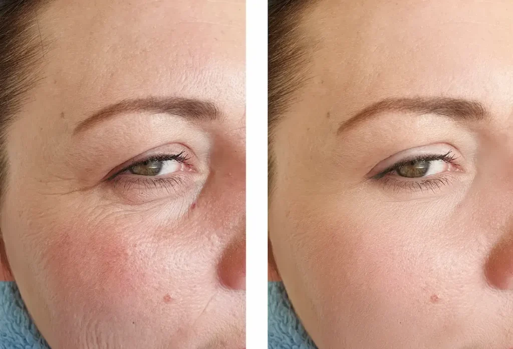 retinol oil