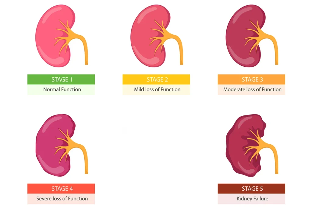 Acute Kidney Disease