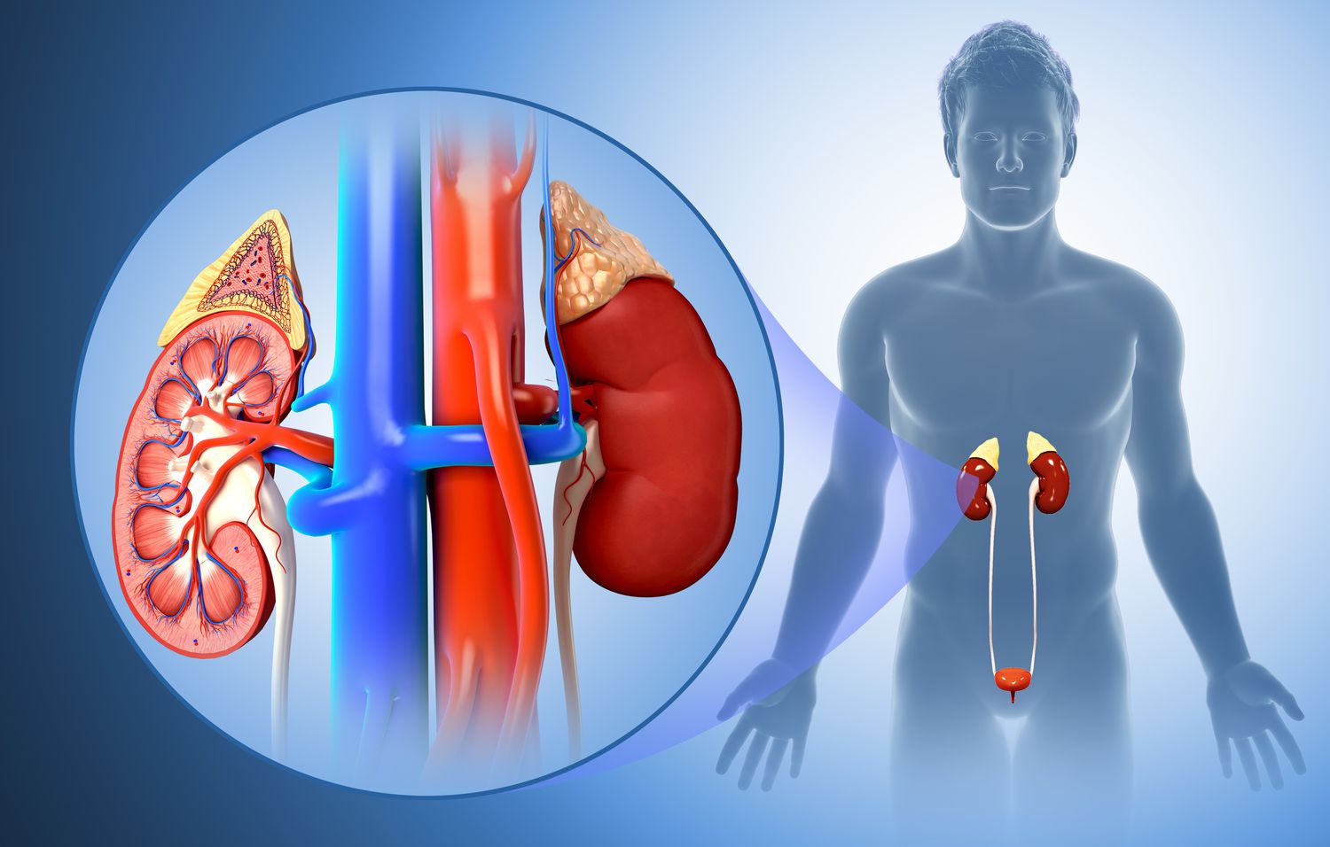 Acute Kidnet Disease
